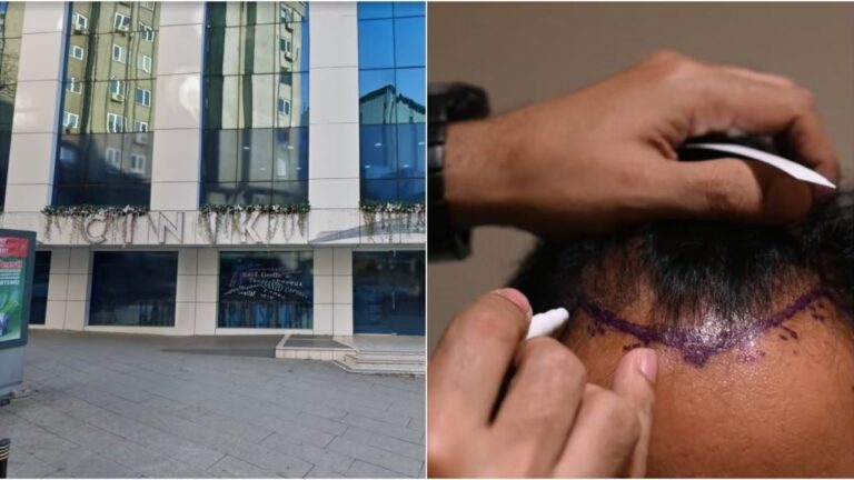 Un turista viajó a Turquía para hacerse un trasplante capilar y perdió la vida