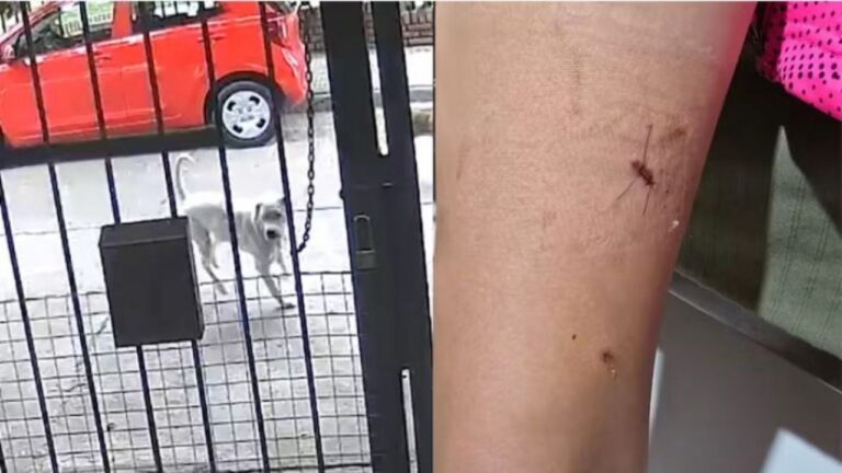 Una nena fue atacada por un perro dogo en Carlos Paz