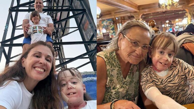 María Victoria Berral, madre de una niña con piel de mariposa